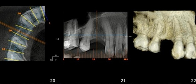 Clínicas de Odonto ganham equipamento de última geração
